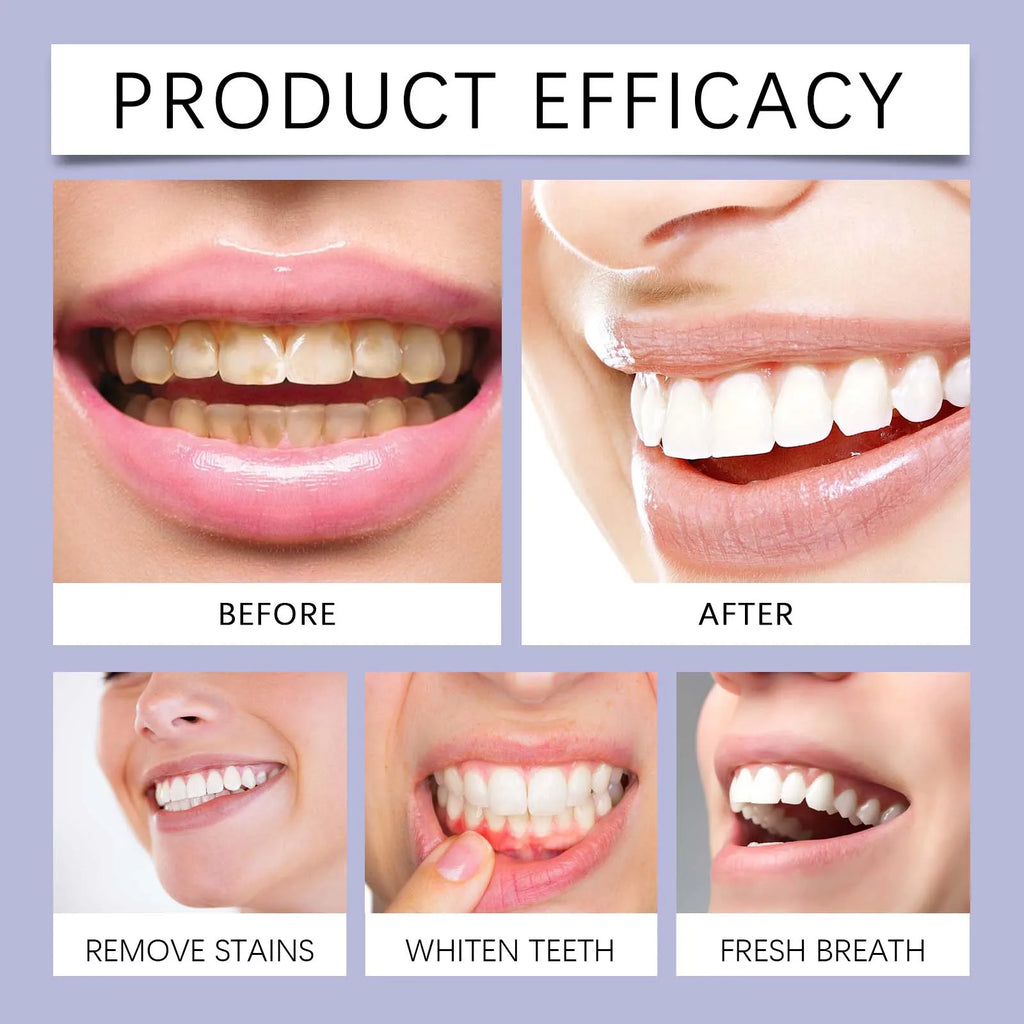 Bucco-Dentaires Issante Pour Les Dents Blanchiment Naturel Des Dents Nettoyage En Profondeur Souffle Frais Quotidien